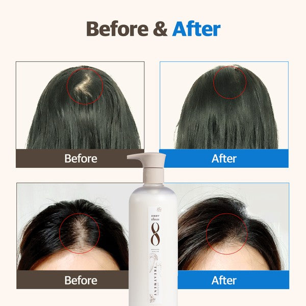 Matsutake Stem Cell Anti-Hair Loss Conditioner